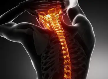 animated x-ray showcasing spine injury